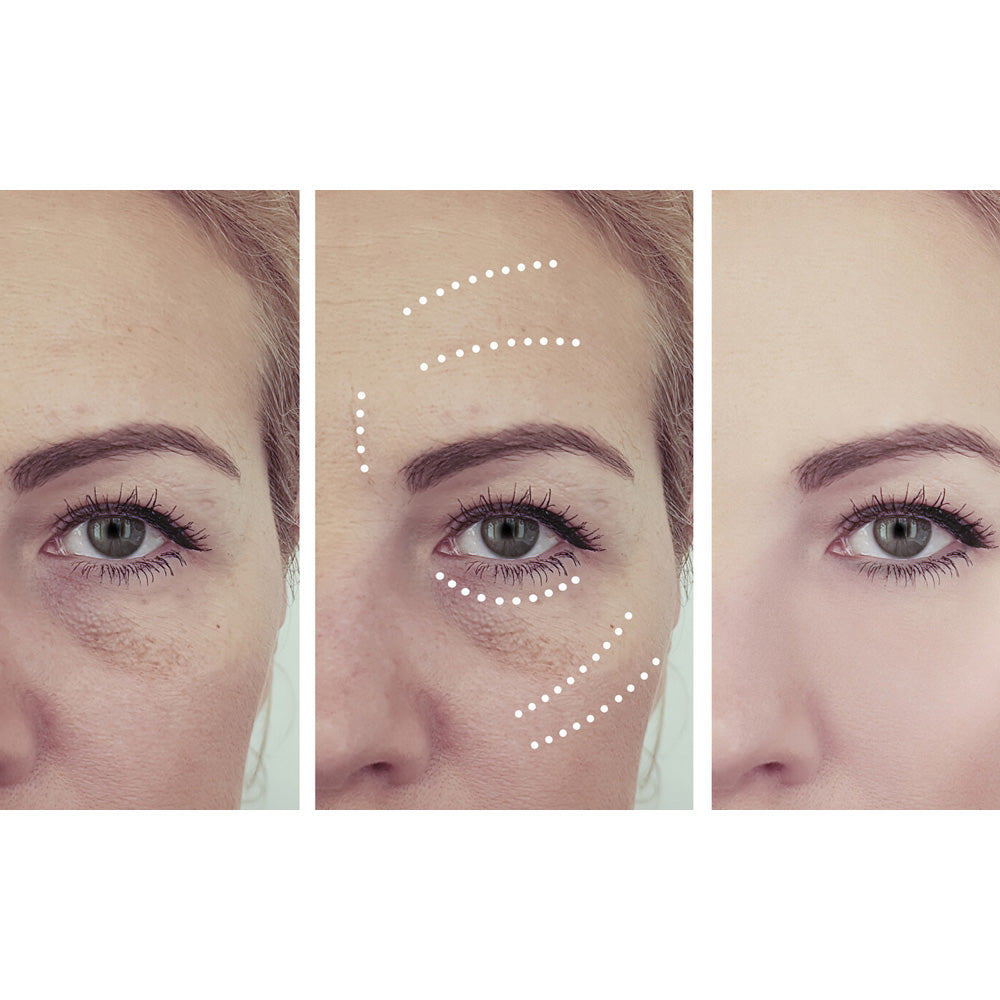 Perfect Miracle Eye Anti-ageing Hyaluronic Acid Serum Before and After Images